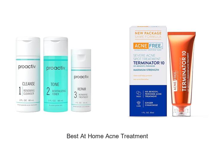 best at home acne treatment