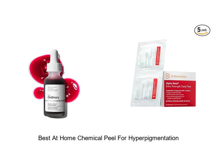 best at home chemical peel for hyperpigmentation