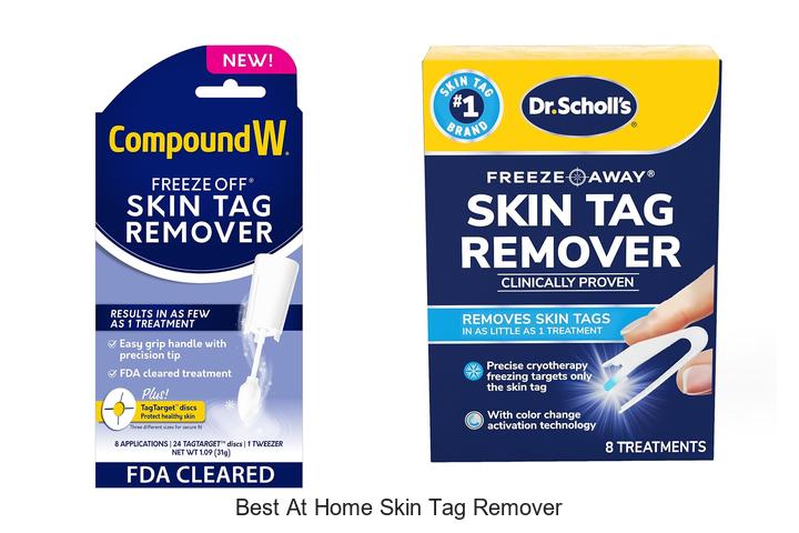 best at home skin tag remover