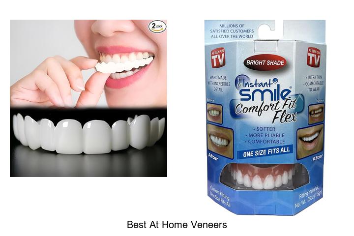 best at home veneers