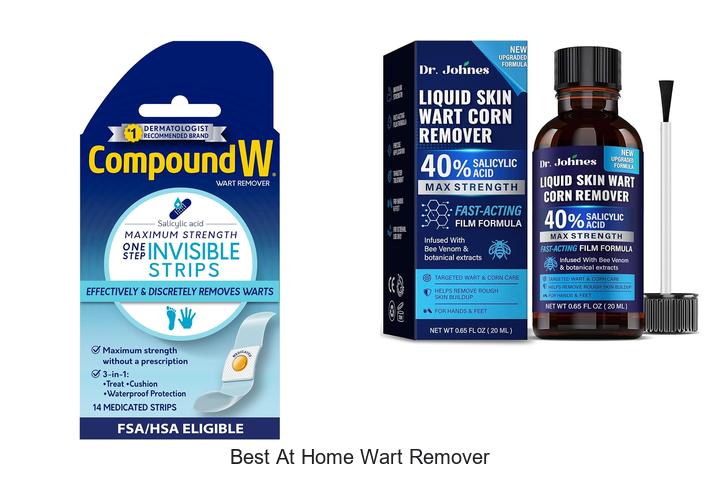 best at home wart remover