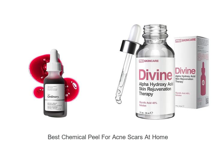 best chemical peel for acne scars at home