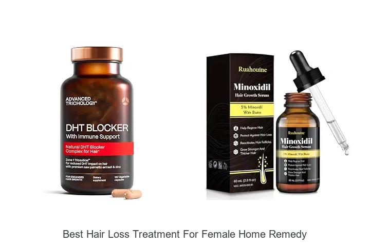best hair loss treatment for female home remedy