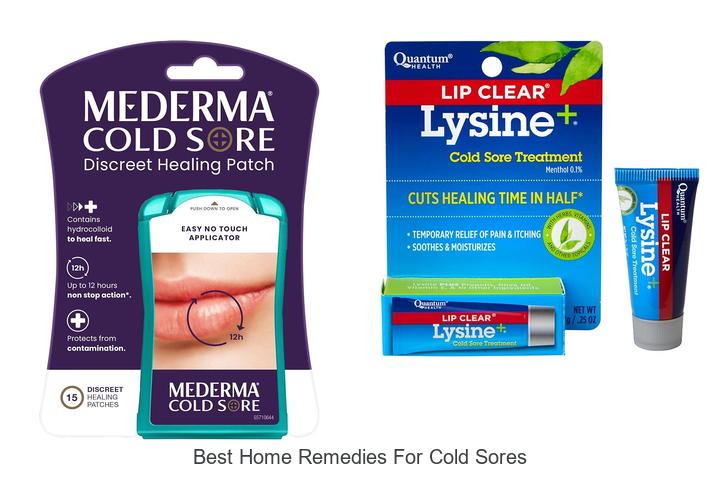 best home remedies for cold sores