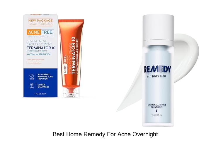 best home remedy for acne overnight