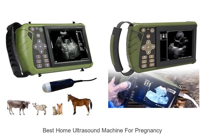 best home ultrasound machine for pregnancy