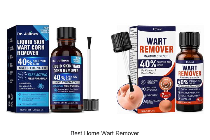 best home wart remover