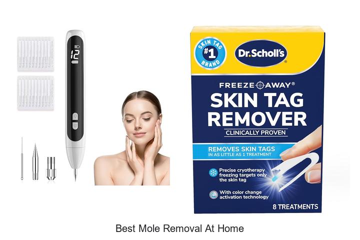 best mole removal at home