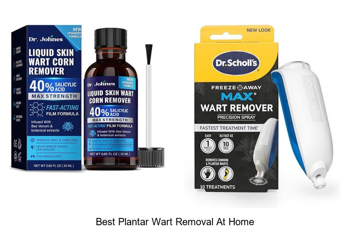 best plantar wart removal at home