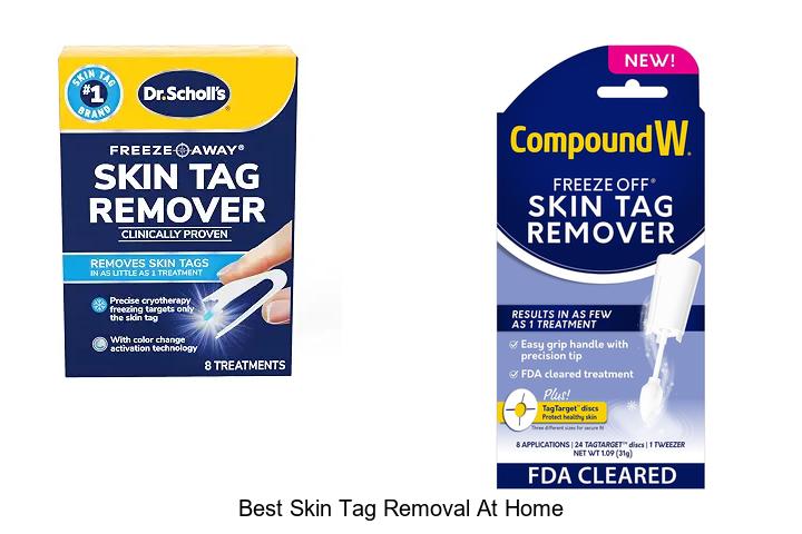best skin tag removal at home