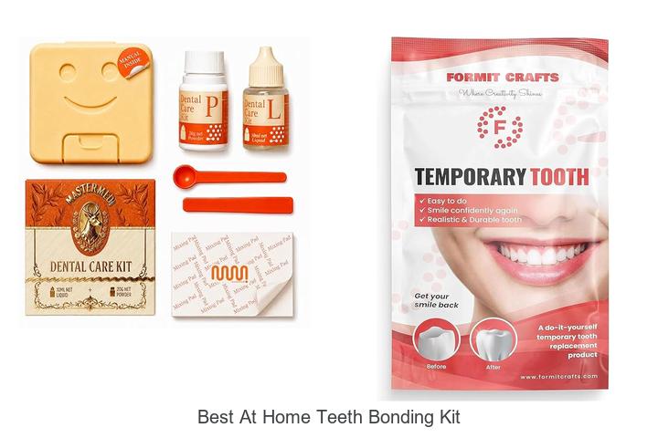 best at home teeth bonding kit